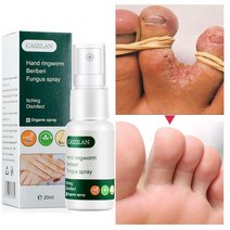 안티 곰팡이 스프레이 발 곰팡이 크림 릴리프 beriberi toe treatment gel for cracked heel 필링 blister repairing feet ointm