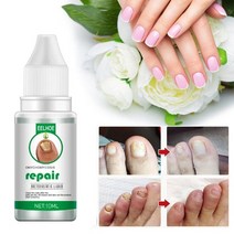 손톱 내성발톱 무좀 곰팡이 연화제 항균 큐티클 오일 에센스 nail fungal treatment feet care 발 수리 paronychia onychomycosis gel a, rt-20ml