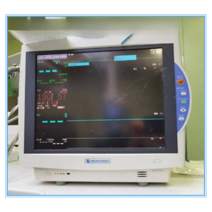 환자감시장치 심전도 측정기 가정용 소형 모니터 차트, 기본