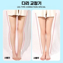 오다리 O자형 X자다리 교정기 휜다리 종아리성형, 어린이 디럭스] O+자석 2쌍