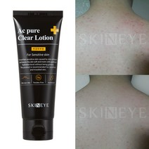 스킨아이 AC 퓨어 클리어 로션, 100ml, 2개