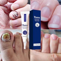 발톱무좀치료 네일 리페어 에센스 손발톱 강화 영양제, 7ml, 1개, 1개