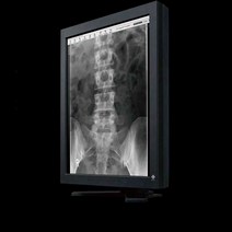 의료용 모니터 수술용 고정밀 화면 X-ray 판독 치과, 21인치 의료용 모니터