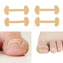 내성발톱 테이프 발톱 파고들때 밴드 패치 파고드는 보호대 막이 풋케어 X10