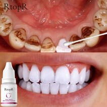 치아 미백제 RtopR 치아 미백 에센스 파우더 구강 위생 청소 세럼 플라크 얼룩 제거 표백 치과 도구, 한개옵션0