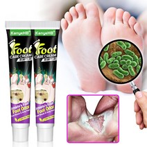 BT 무좀 치료 발가려움 연고 FOOT, 2개, 20g, 1개