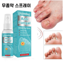 무좀 치료 발가려움 스프레이 에센스 항감염 무좀치료제 풋 케어 세럼, 50ml, 5개, 1개