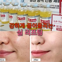 ﻿실리프팅 3개국특허 톡스 앰플 30ml/주름골 콜라겐 안티에이징 ﻿, 2)실리프팅 주름골앰플1+1세트