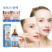 West&Month 1+1 보톡스 펩타이드 눈가 이마 미간 팔자 주름보 필러 보톡스 원액, 30ml