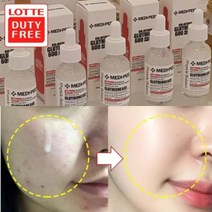 검버섯제거 기미뿌리제거 에센스 30ml/7일후 놀라운변화/미백기능성앰플 기미잡티제거, 1)미백세포에센스1+1+1세트