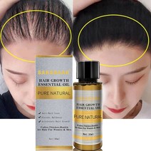 탈모예방 여성탈모 남자탈모 남성탈모 모근강화 발모 모발 탈모 탈모방지 샴푸 기능성 탈모기능성 탈모샴푸순위 헤어토닉 헤어에센스 헤어오일 모발 관리 모발 성장 에센셜 오일 정통