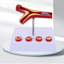 동맥 경화증 혈관 모형 모델 인체 교육용품, 기본