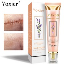 스킨케어 바디케어 라벤더 흉터 리페어 크림 리페어링 화상 흉터 세포 재생 촉진 탄력 강화 오이 스킨 케어 20g, 한개옵션0