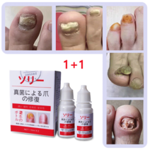 발톱무좀 리페어 세럼 발톱연화 발톱 무좀 조갑사상균증 살균, 4개, 10ml