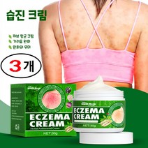 5개 3개 피부건선 건선 피부 발진 피부가려움증 피부 두드러기 30g