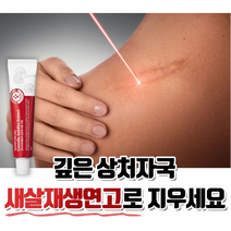 성분에디터 마데카연고 국내1위 상처연고 제약사, 1개