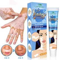 LANEMAY 백반증 피부 백반증 백반증원인 얼굴백반증 20g