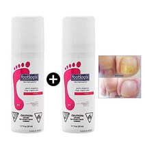 1+1 Footlogix 풋로직스 안티 펑거 발톱 스프레이 50ml (2개)