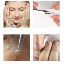 여드름 짜는 도구 블랙헤드 피지 비립종 압출 바늘 집게 짜는 기계 피부과 물사마귀 제거, L형