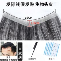남자부분가발 정수리 앞머리 통 피스 M자 똑딱이 헤어라인 투명 대머리, [1.5*16CM]바이오 마스크 헤어라인 패치