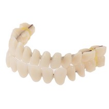 음성인식 ai 스피커 수지 틀니 모델 내구성 치과 재료 교육 인공 제조, 01 1pair