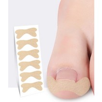 발톱무좀 레이저 가정용 손톱 발톱 무좀관리 발가락 곰팡이 케어관리 발톱무좀 레이저 가정용 손톱 발톱 무좀관리 발가락 곰팡이 케어관리 페디큐어 자란 손톱 도구 발톱 스티커 치료, 피부