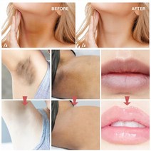 y존 착색크림 사타구니 미백 색소침착 팔꿈치 복숭아뼈 착색 인티미트 에어리어 핑크 바디, 1개