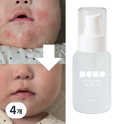 모요모요 침독크림 아기태열 초등학생앰플 고학년 사춘기 여드름화장품, 4개, 50ml
