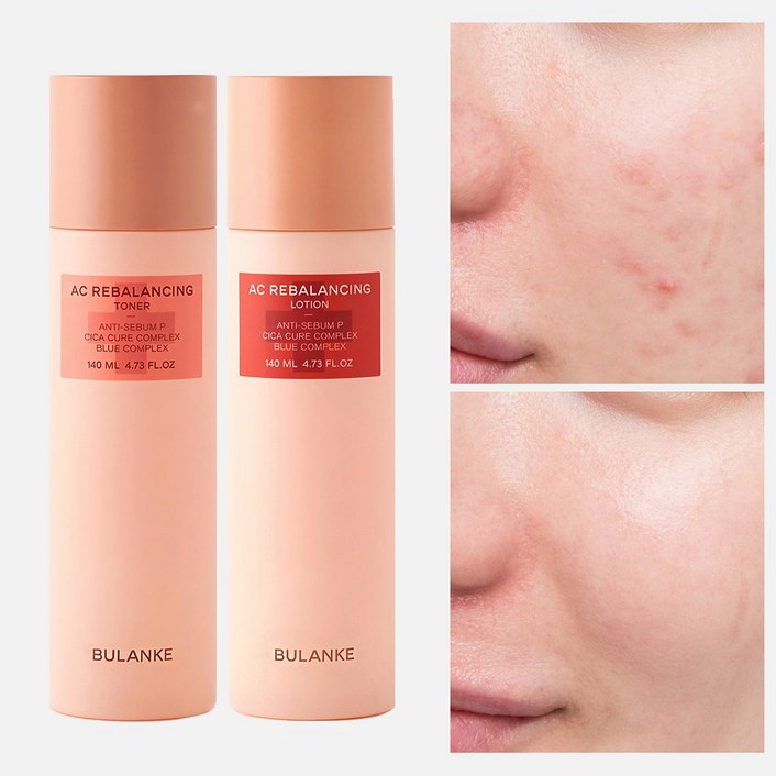불란케 에이씨 리밸런싱 2종세트 청소년 사춘기 민감성 여드름 스킨로션