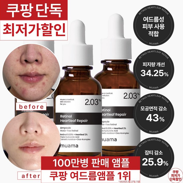 3일 여드름 재생진정 흉터 개선 앰플 100만병 판매기념 한정 할인 여드름 흉터  좁쌀 피지 개선 임상완료 레티놀 어성초 히알루론산 나이아신아마이드 뮤아마 앰플, 3개, 30ml