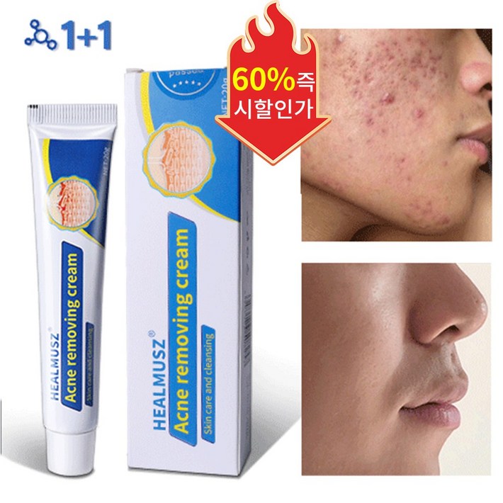 당일배송 여드름 연고 여드름 치료 스킨 배리어 리커버리 수부지 관리 크림, 2개, 20ml