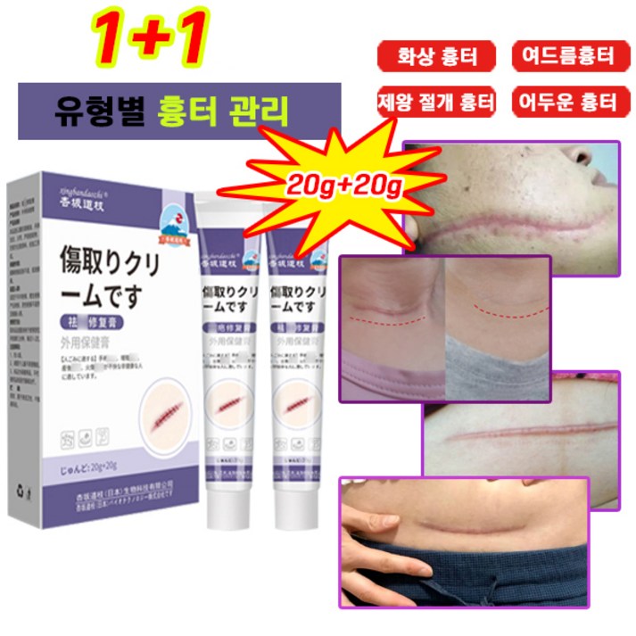 100제거당일배송 흉터제거연고 상처흉터연고 여드름 연고 민감한 피부를 수술 화상 제왕절개 수술흉터 연고 100제거당일배송 흉터제거연고 상처흉터연고 여드름 연고 민감한 피부를 수술 화상 제왕절개 수술흉터 연고
