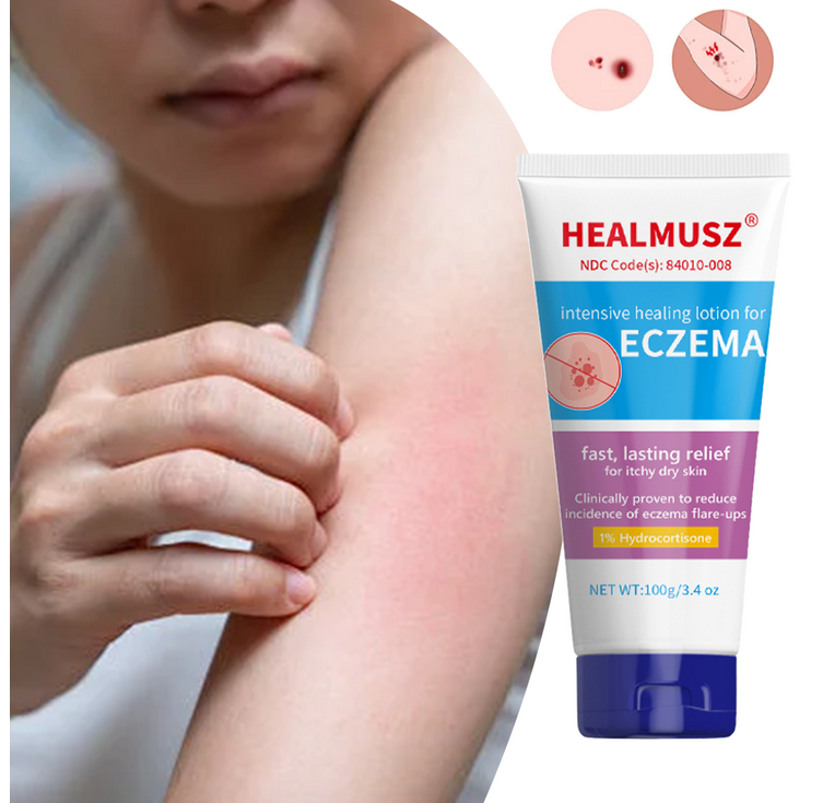 HEALMUSZ습진연고,완화되다 피부 가려움증 습진 건선 아토피 피부염 헤르페스 수분 크림, 2개, 100ml